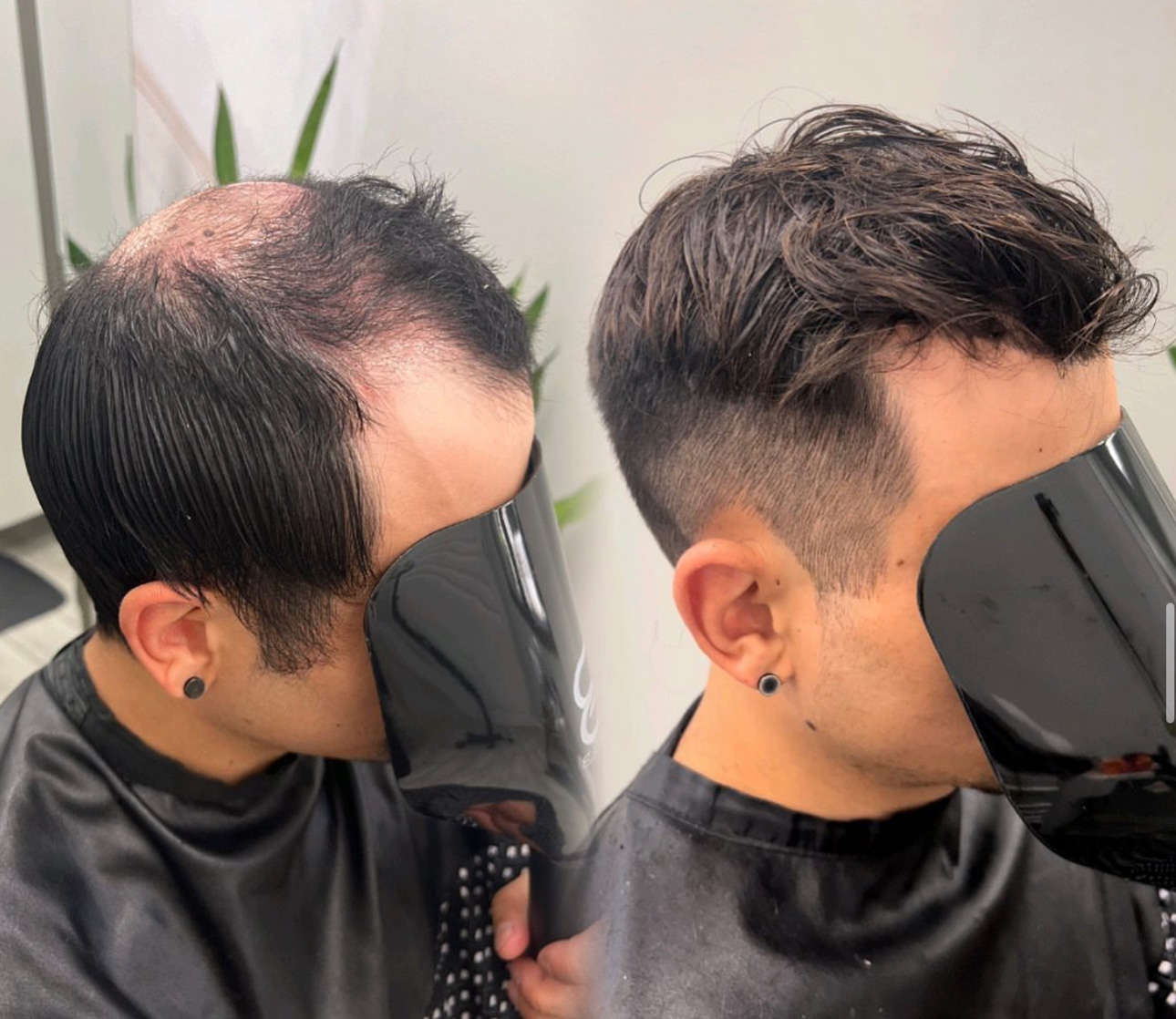 Men's hair system before-and-after result with dark styled hair in Huntersville, North Carolina